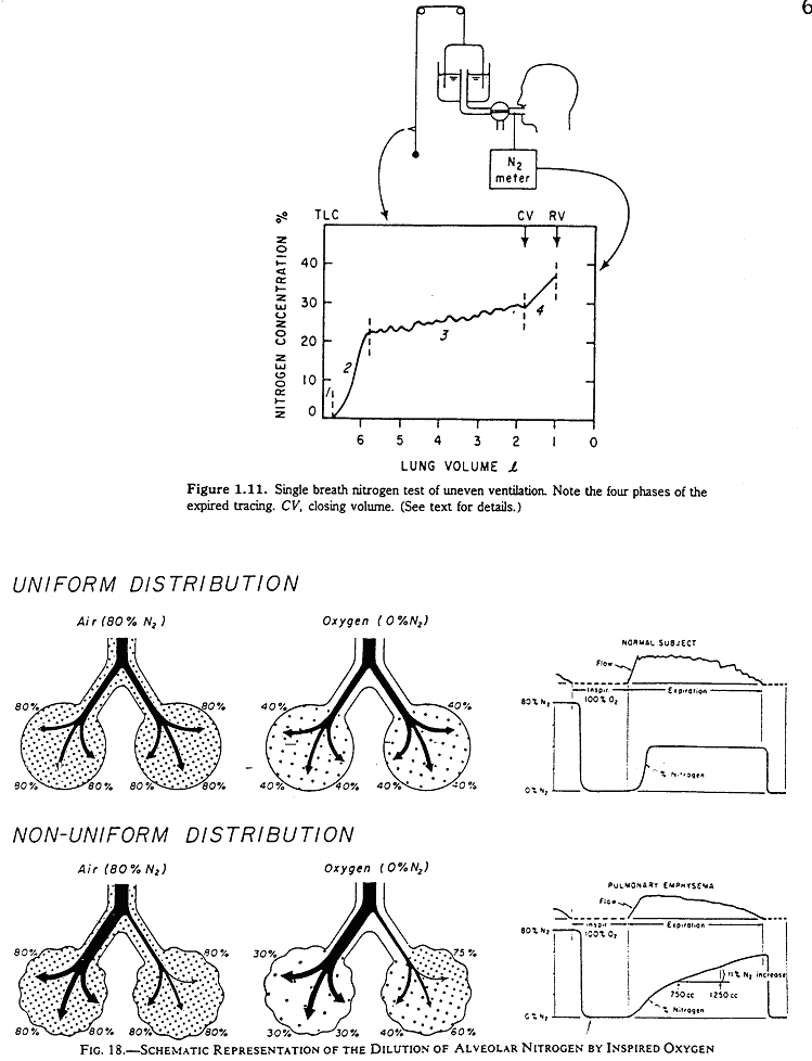 single breath nitrogen washout test